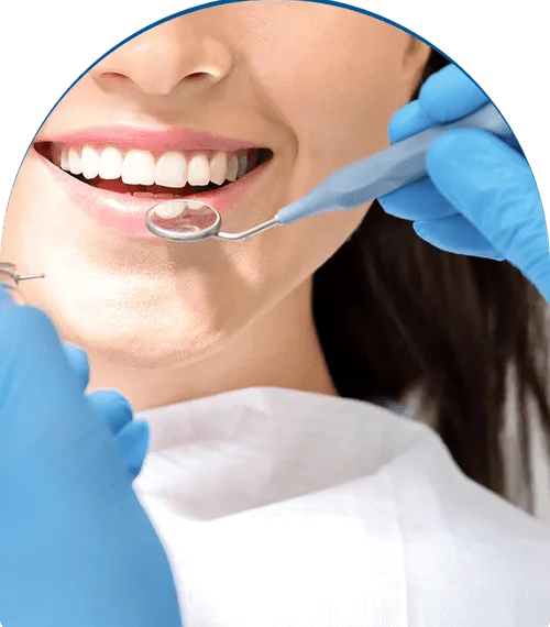 Why Should You Choose a Teeth Whitening Dentist Instead of Over-the-Counter Products?